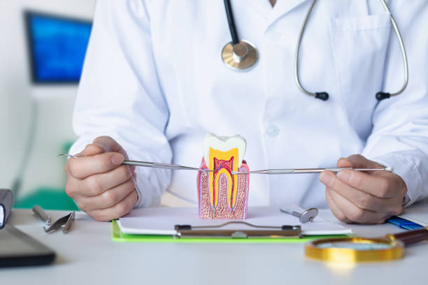 Best Knocked-Out Tooth (Avulsed Tooth) Treatment in Moulton, AL